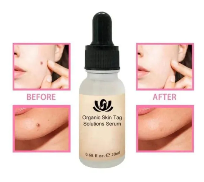Careovate Natural Spots Free Serum Vibrators