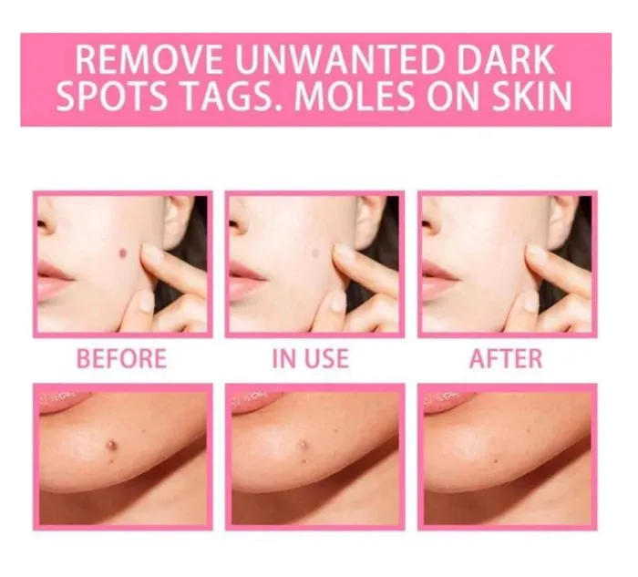 Careovate Natural Spots Free Serum Vibrators
